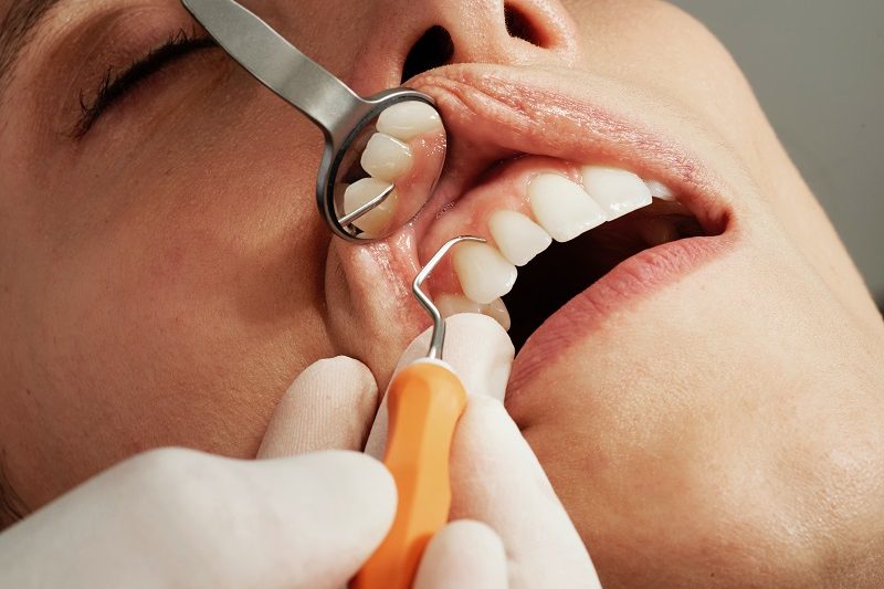 Dental Exams
